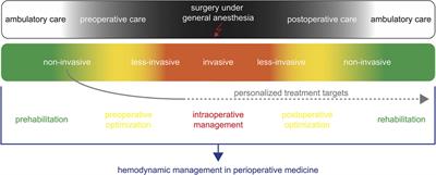 Non-Invasive Hemodynamic Monitoring for Hemodynamic Management in Perioperative Medicine